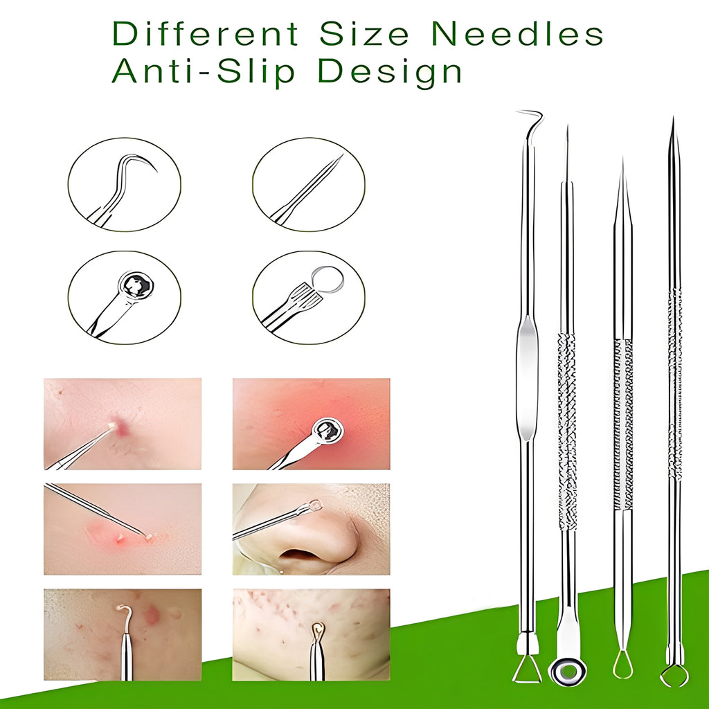 Blackhead Remover Tool Kit - Professional Stainless Steel Pimple Extractor Set