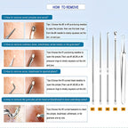 Blackhead Remover Tool Kit - Professional Stainless Steel Pimple Extractor Set
