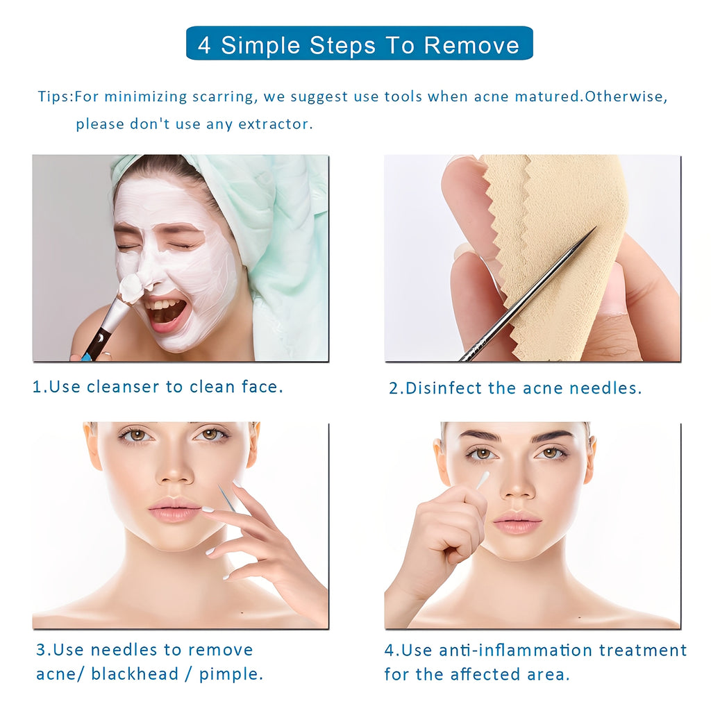 Blackhead Remover Tool Kit - Professional Stainless Steel Pimple Extractor Set