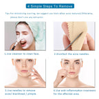 Blackhead Remover Tool Kit - Professional Stainless Steel Pimple Extractor Set