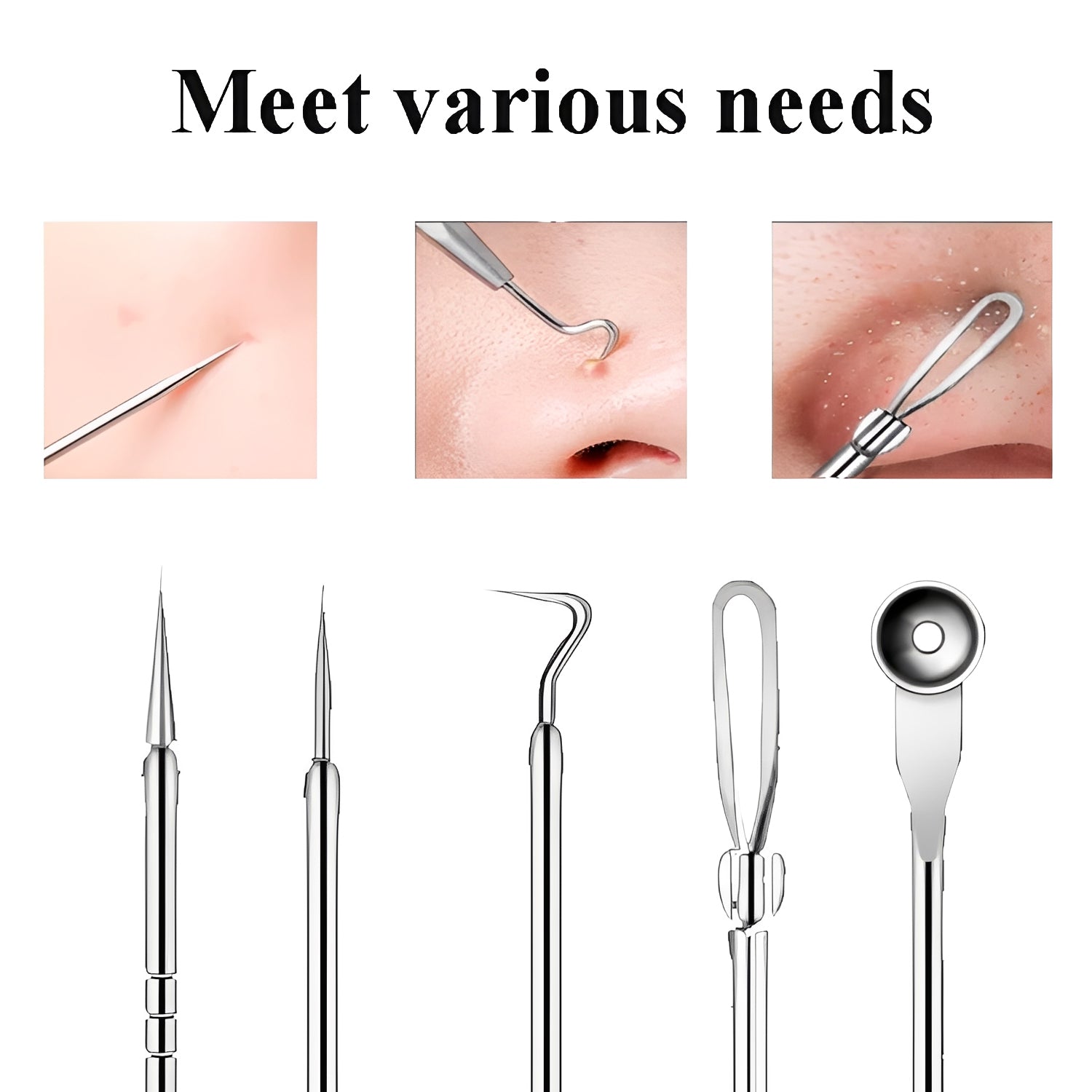 Blackhead Remover Tool Kit - Professional Stainless Steel Pimple Extractor Set