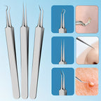 Blackhead Remover Tool Kit - Professional Stainless Steel Pimple Extractor Set