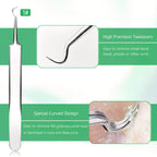 Blackhead Remover Tool Kit - Professional Stainless Steel Pimple Extractor Set