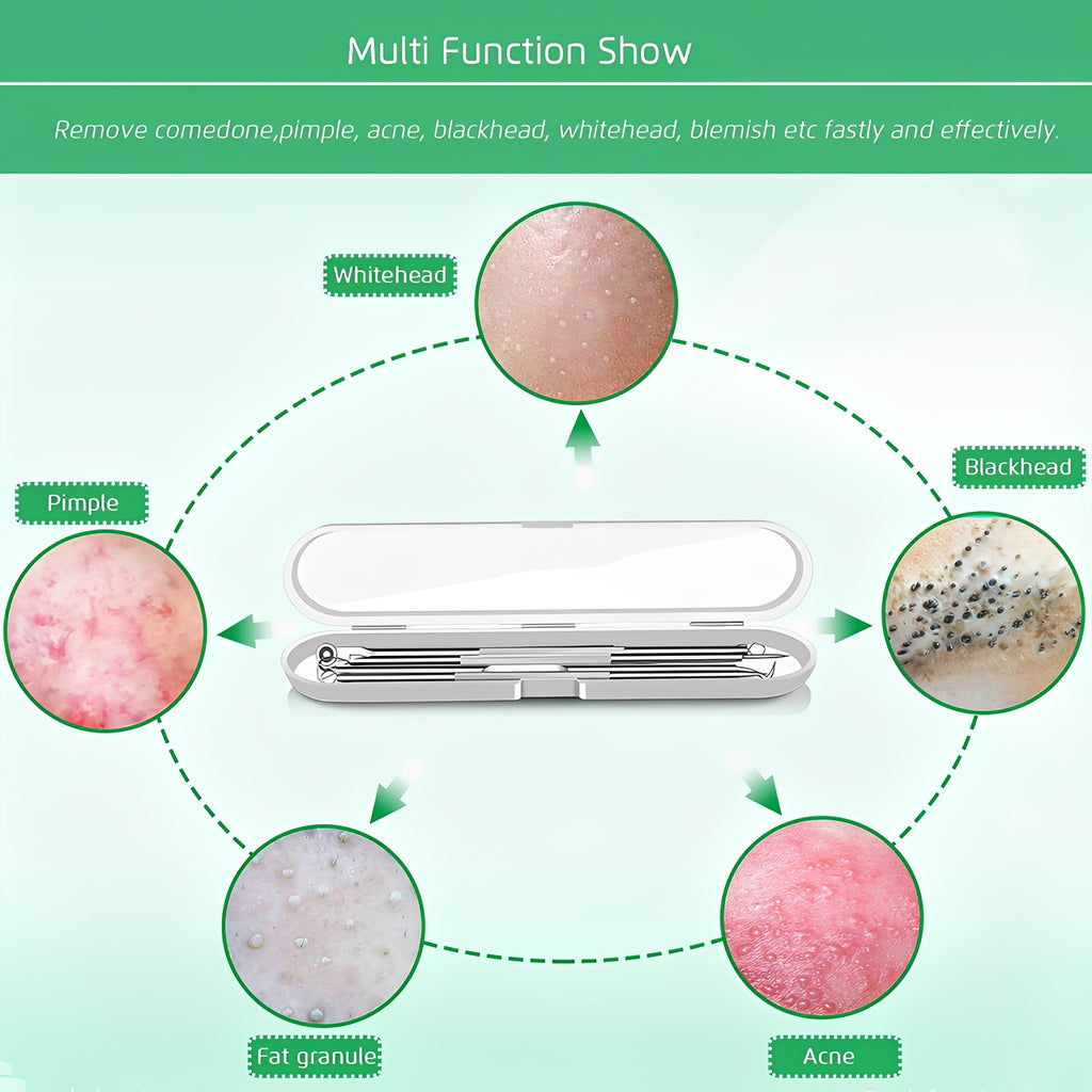 Blackhead Remover Tool Kit - Professional Stainless Steel Pimple Extractor Set